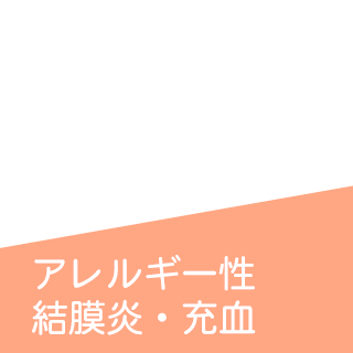 アレルギー性 結膜炎・充血